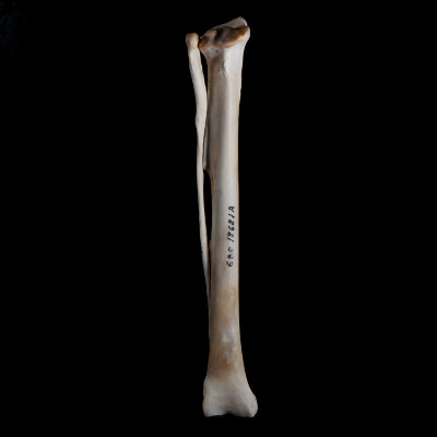 Nasal_view