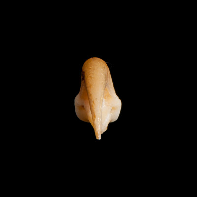 Nasal_view