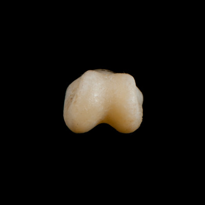 Basal_view