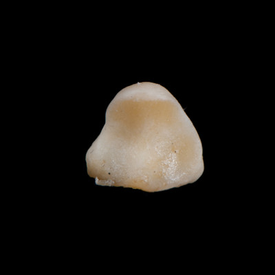 dorsal_view