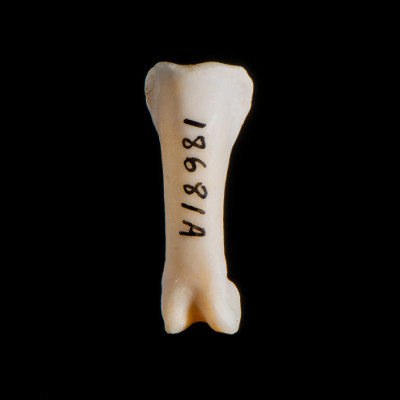 Nasal_view