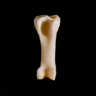 Nuchal_view