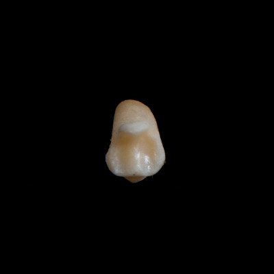 Nuchal_view