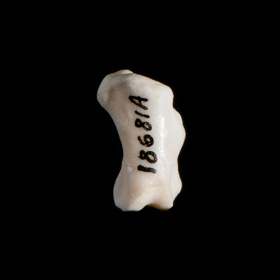 Nasal_view