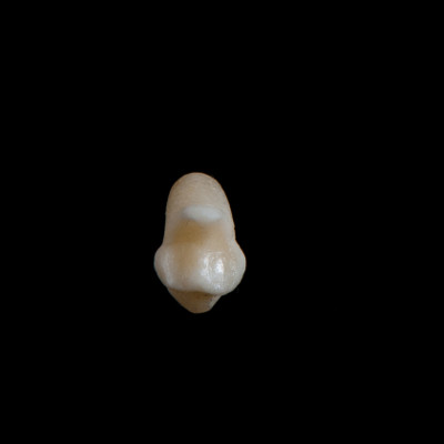 Nuchal_view
