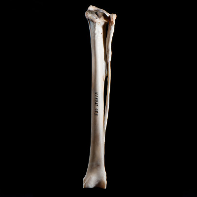 Nasal_view
