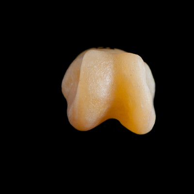 Basal_view