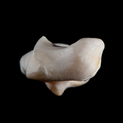 Basal_view