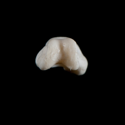 Basal_view