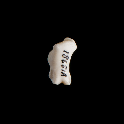 Nasal_view