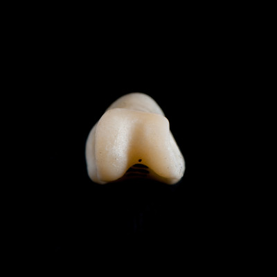 Basal_view