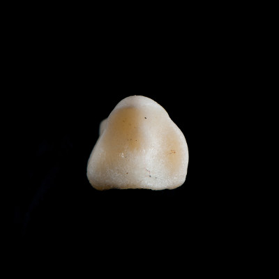 dorsal_view