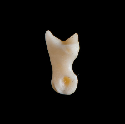Left_side_view