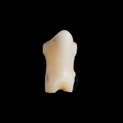 Nasal_view