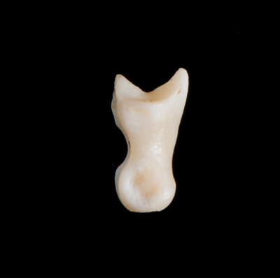 Right_side_view