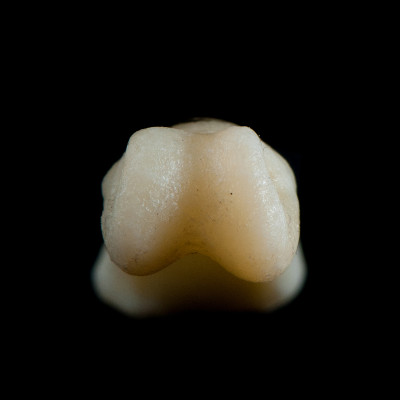 Basal_view