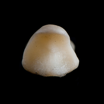 dorsal_view