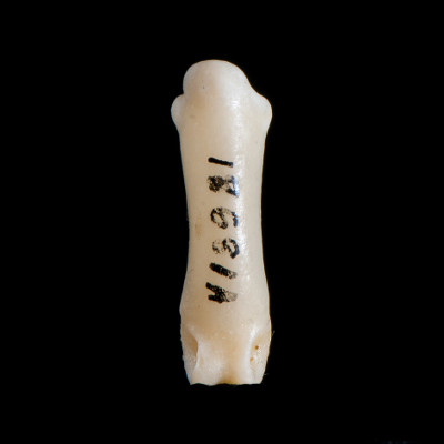 Nasal_view