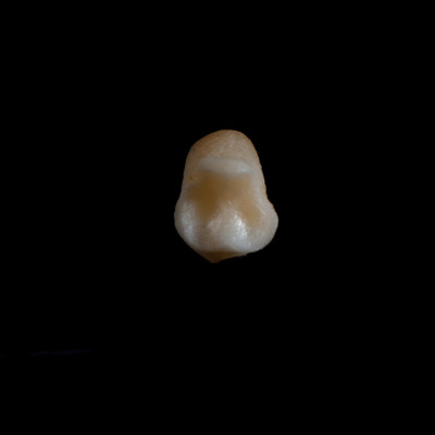 Nuchal_view